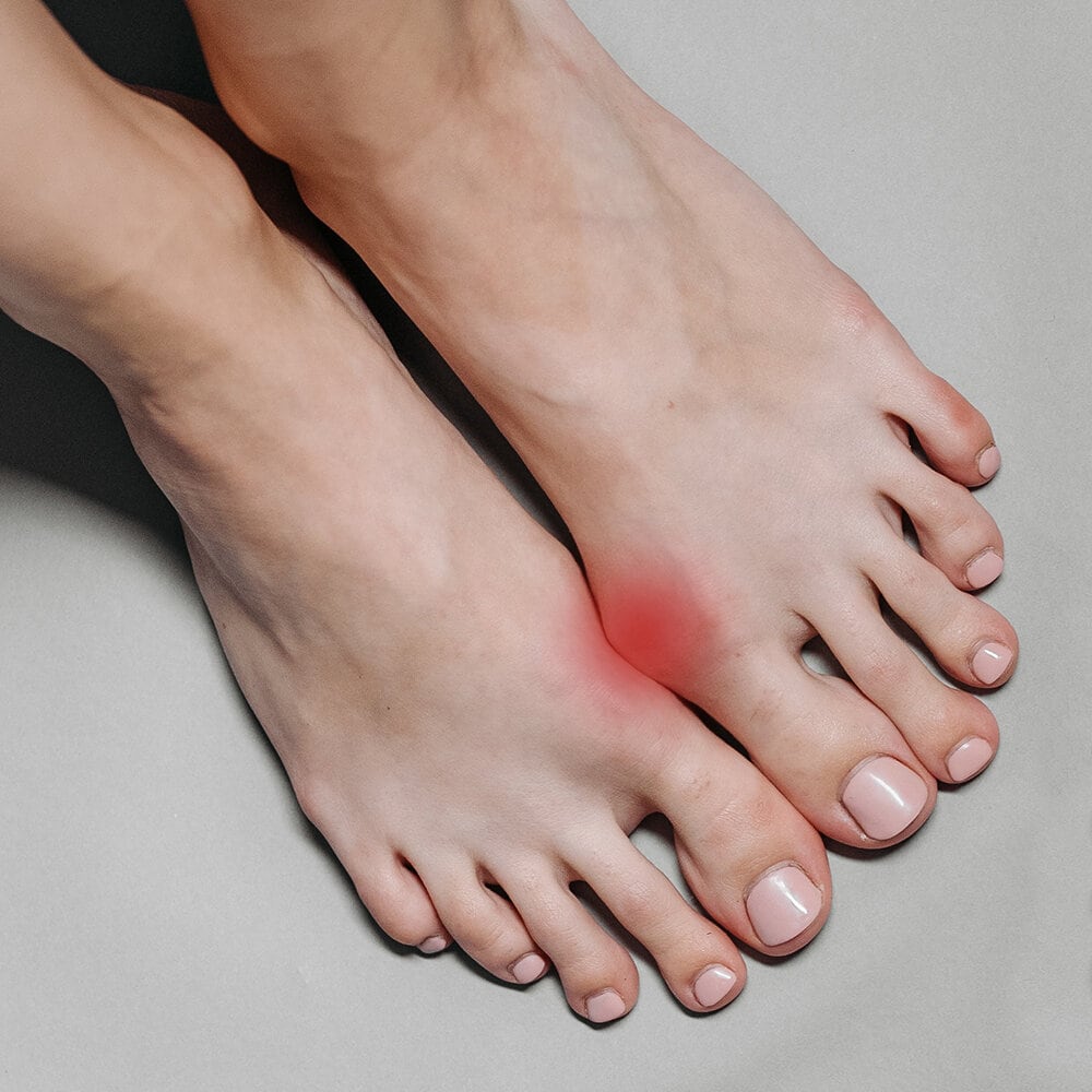 https://www.minfot.dk/pub_docs/files/404content/hallux-valgus.jpg