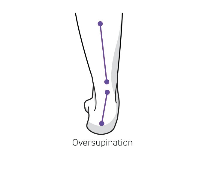 https://www.minfot.dk/pub_docs/files/Hurvetjagomjagpronerarellersupinerar/overdriven-supination.jpg