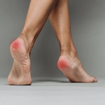 Har du smerter omkring hælen?